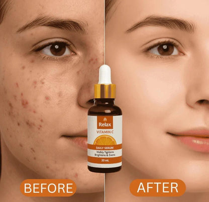 Relax Vitamin C Daily Serum - 30ml | Visibly Brightens, Evens Skin Tone, and Reduces Aging Signs for a Radiant, Youthful Glow